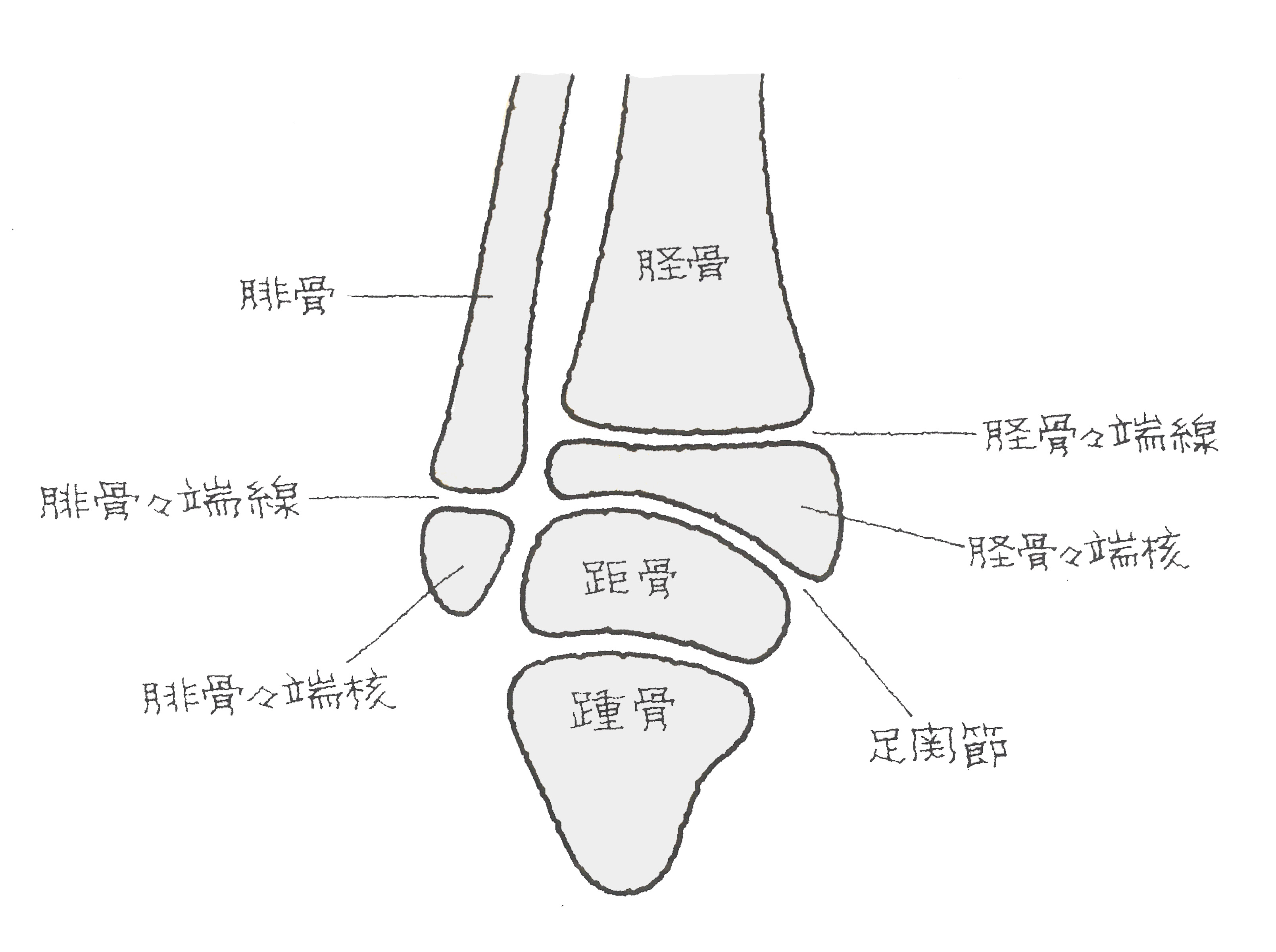 腓骨 遠 位 端 骨折