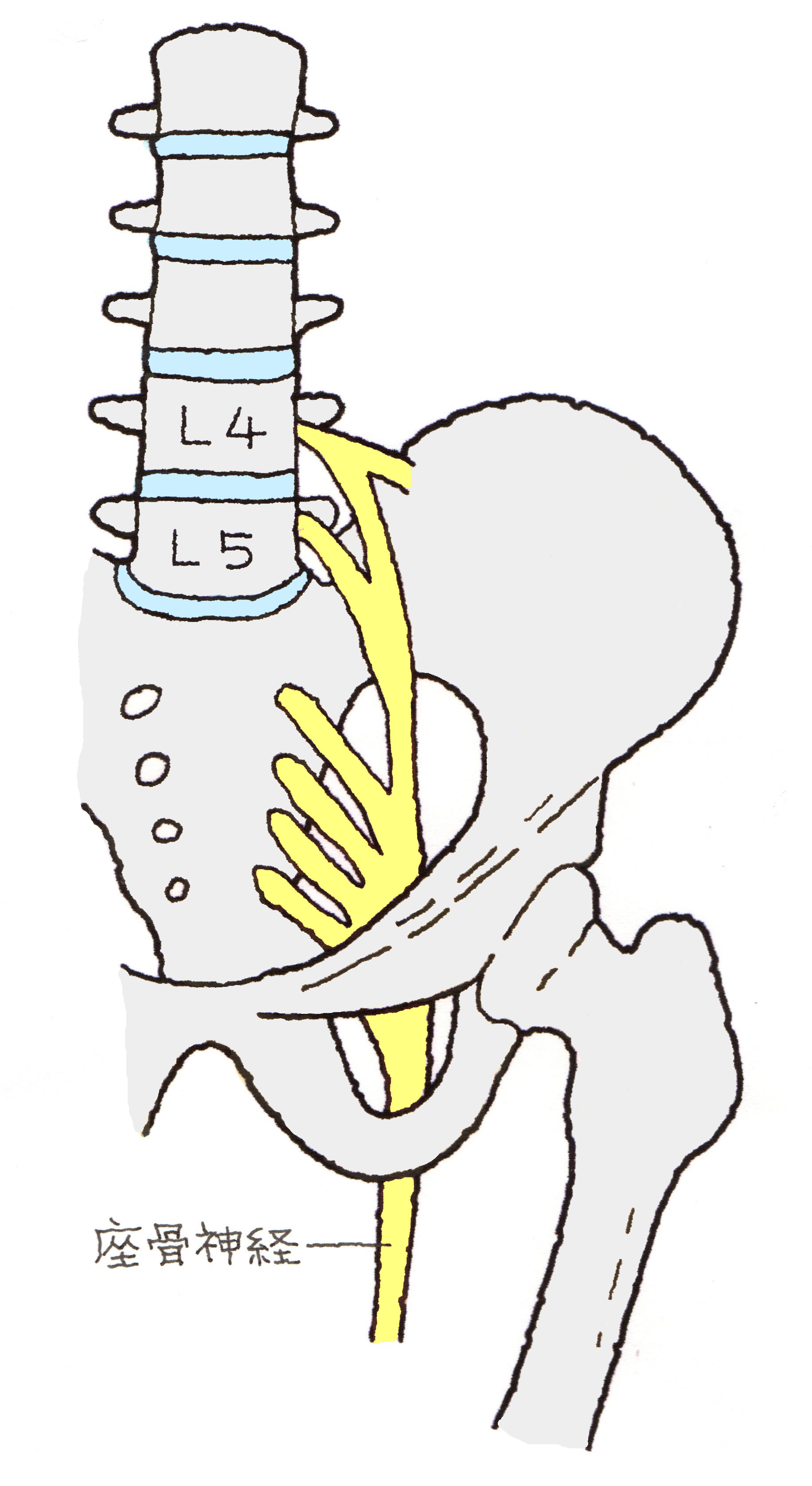 神経痛 股関節 坐骨