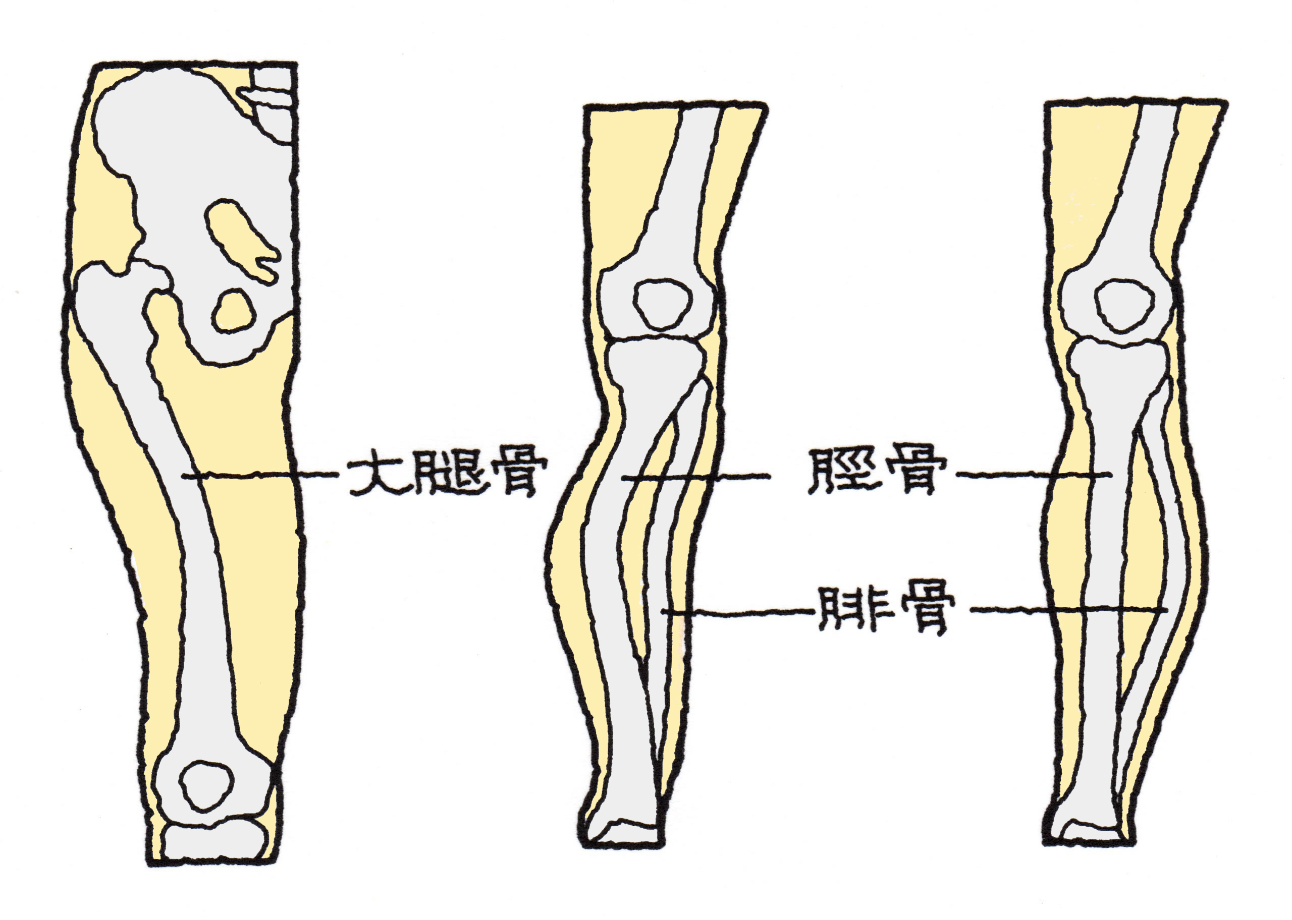 大腿骨骨折 – 大腿骨骨折 良肢位 ポジショニング – Trfile