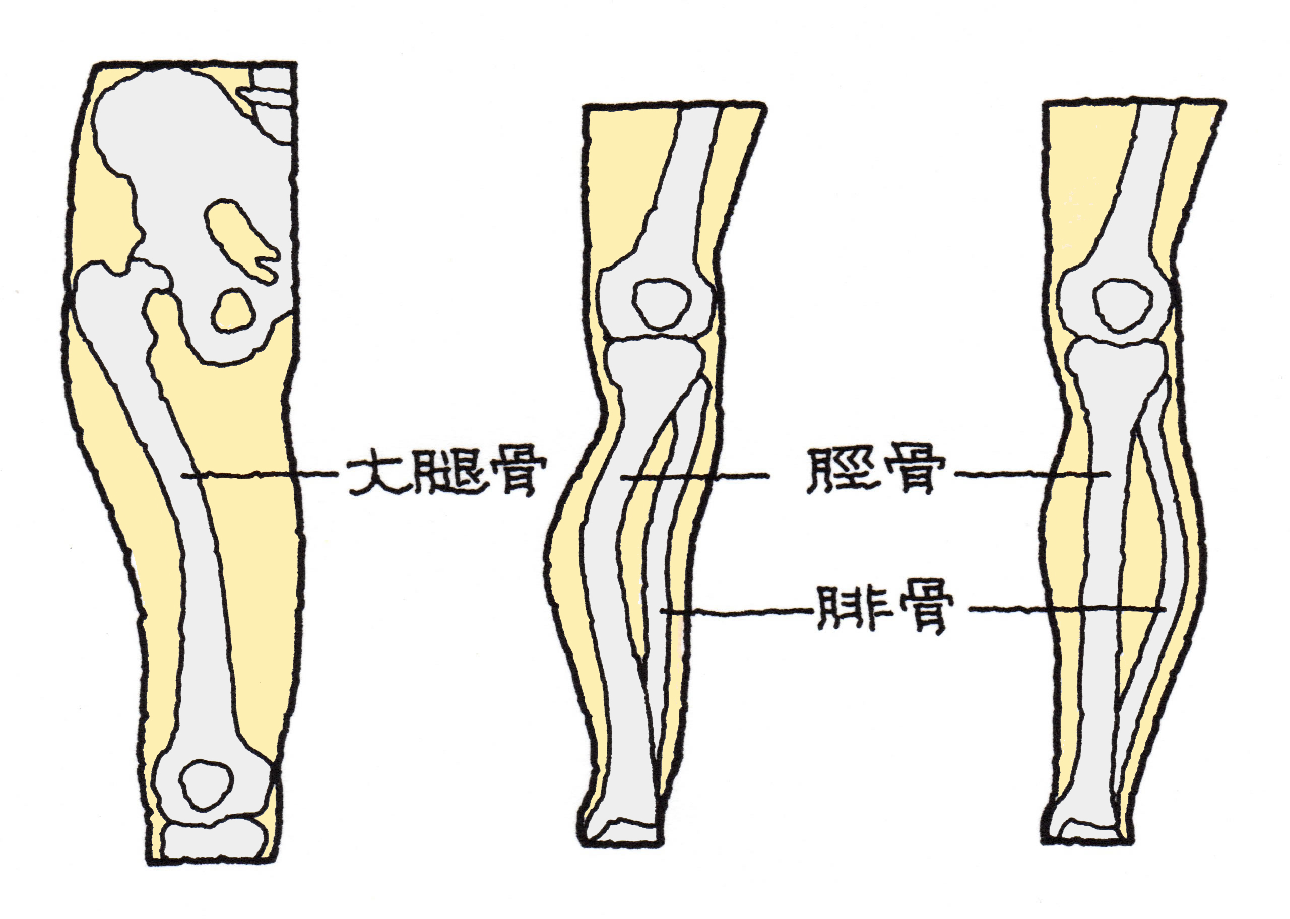 だいたい こつ てん しか 骨折