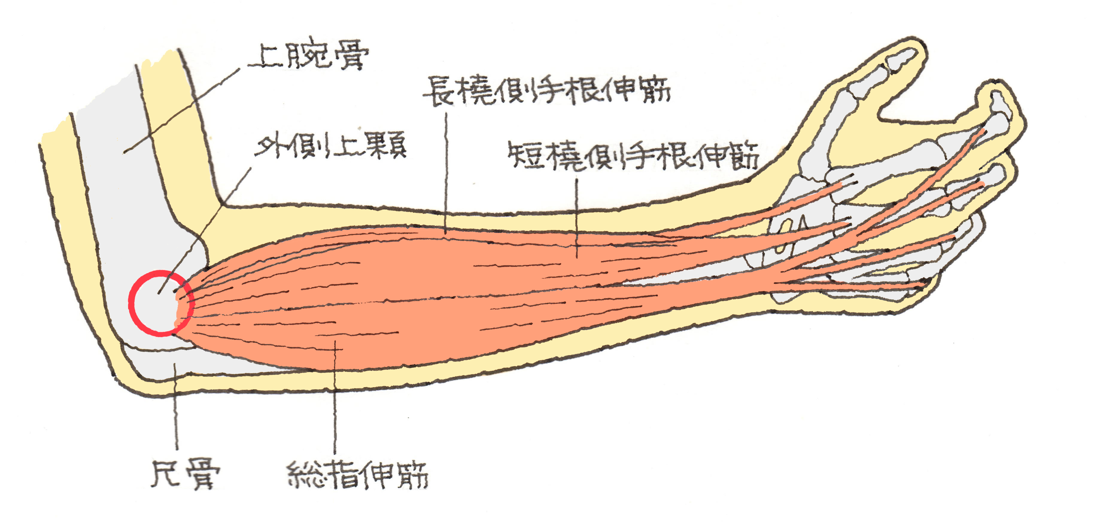 手首 から 肘 にかけて の 痛み