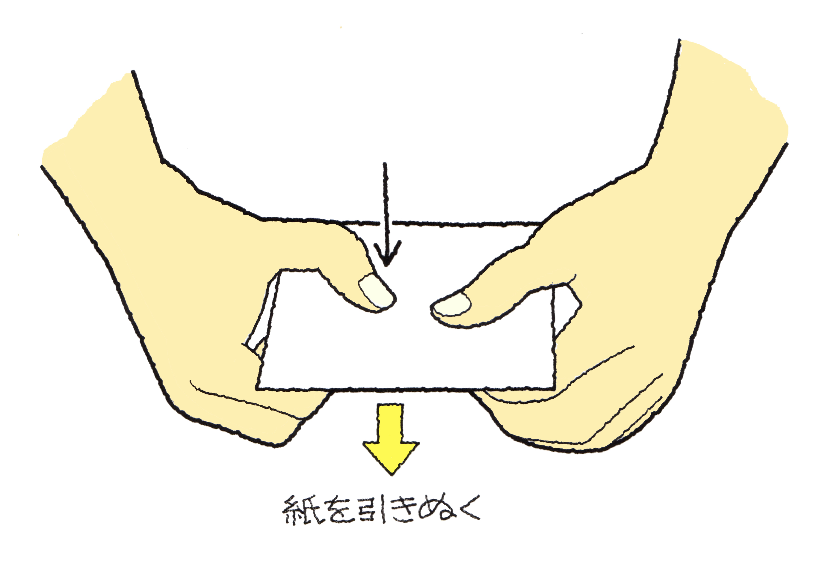 徴候 フロー マン 身体所見：Froment'sign Froment徴候