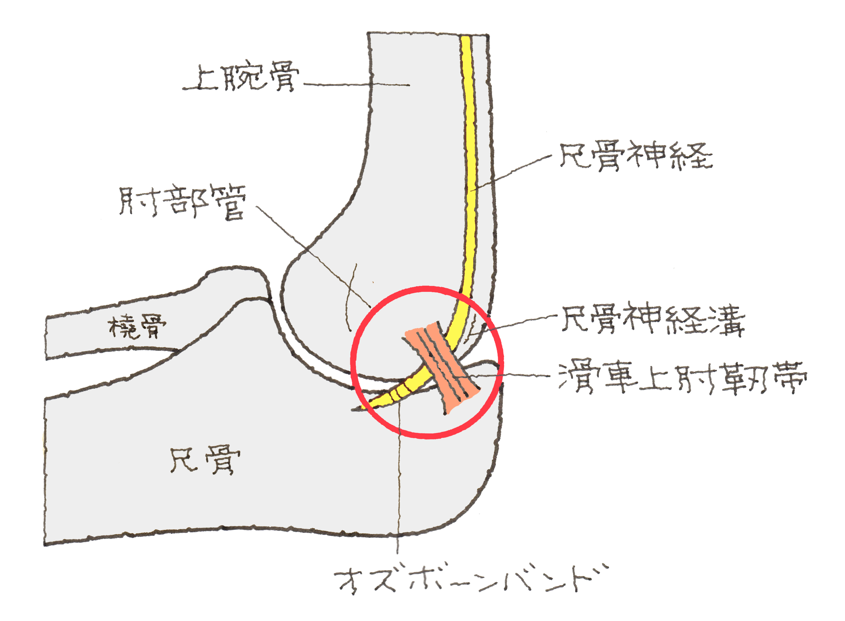 症候群 管 肘 部