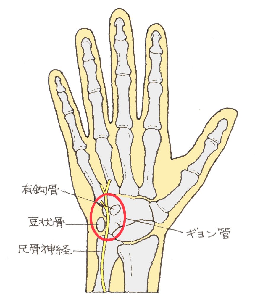 ギヨン管症候群 福岡の弁護士による後遺障害・等級認定サポート