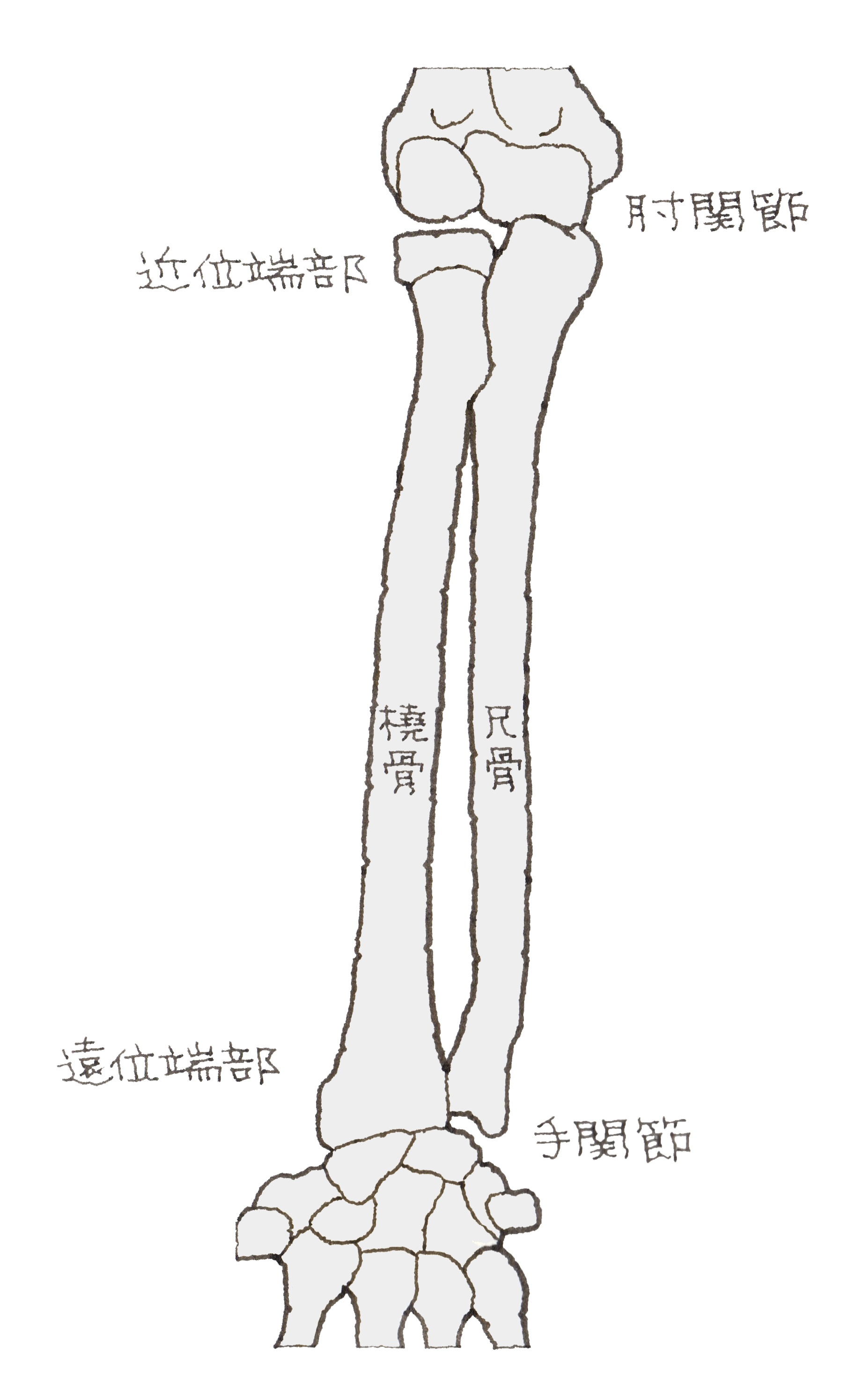 尺桡骨远端粉碎性骨折（切复内固定术）