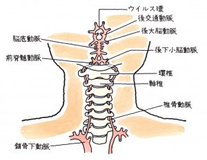 椎骨脳底動脈血行不全症 ついこつのうていどうみゃくけっこうふぜんしょう 福岡の弁護士による後遺障害 等級認定サポート